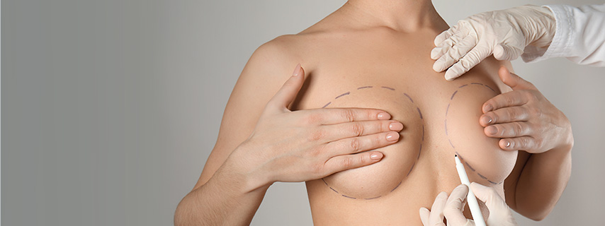 Mamoplastía